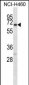 GABRA4 Antibody (Center)