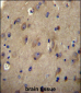 CNRP1 Antibody (Center)