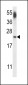 CNRP1 Antibody (Center)