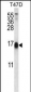 SKA2 Antibody (N-term)