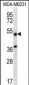 TRIM10 Antibody (C-term)