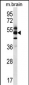 GPS1 Antibody (Center)