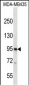 CNGB3 Antibody (N-term)