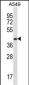 FBLIM1 Antibody (C-term)