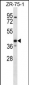 KCNK1 Antibody (C-term)