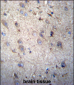 GSTM5 Antibody (N-term)