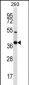 NKX2-2 Antibody (Center)