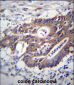 KRT12 Antibody (C-term)