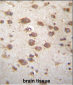 STAP2 Antibody (Center)