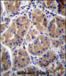 RAB27B Antibody (Center)