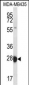 RAB27B Antibody (Center)