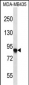 AFAP1 Antibody (C-term)