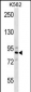 STRN4 Antibody (N-term)