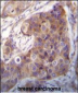 Bit1 Antibody (Center)