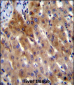 IL-27 Antibody (Center)