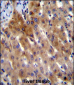 IL-17D Antibody (Center)