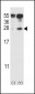 IL-17D Antibody (Center)