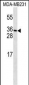 PDGFC Antibody (N-term)