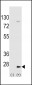 UBE2H Antibody (C-term)