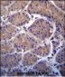 USP20 Antibody (C-term)