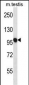 USP20 Antibody (C-term)