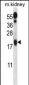 Ufc1 Antibody (C-term)