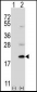 Ufc1 Antibody (C-term)