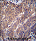 ARL2 Antibody (C-term)