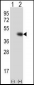 TPST1 Antibody (C-term)