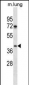 TPST1 Antibody (C-term)