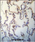 RAGE (AGER) Antibody (C-term)