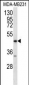 RAGE (AGER) Antibody (C-term)