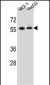 MGAT2 Antibody (C-term)