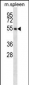 EDG6 Antibody (N-term)