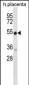 NRG3 Antibody (C-term)