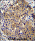 ST14 Antibody (C-term)