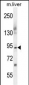 ST14 Antibody (C-term)