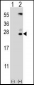 Kallikrein 6 Antibody (N-term)