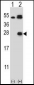 Kallikrein 6 Antibody (Center)