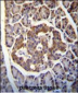 Kallikrein 8 Antibody (Center)