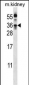 Kallikrein 8 Antibody (Center)