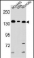 Metabotropic Glutamate Receptor 1 Antibody (C-term)