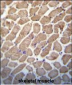 Hamartin (TSC1) Antibody (Center)
