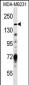 Hamartin (TSC1) Antibody (Center)