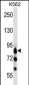 MARK3 Antibody (C-term)