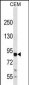 MAP3K13 (LZK) Antibody (C-term) (S869)