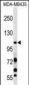 PIK3CB Antibody (N-term S139)