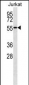 NUP50 Antibody (ascites)