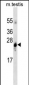 GSTA1 Antibody (ascites)