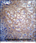 CDCA8 Antibody (N-term)